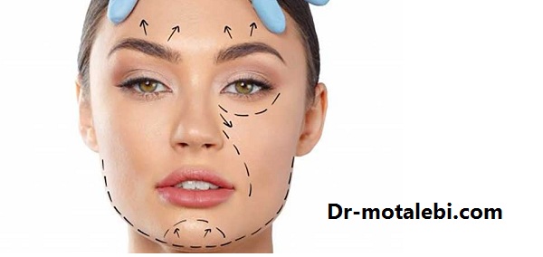 بهترین روش لیفتینگ صورت - کلینیک دکتر فهیمه مطلبی