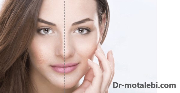 سابسیژن - کلینیک دکتر فهیمه مطلبی