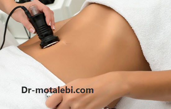 لاغری با کویتیشن - کلینیک دکتر فهیمه مطلبی