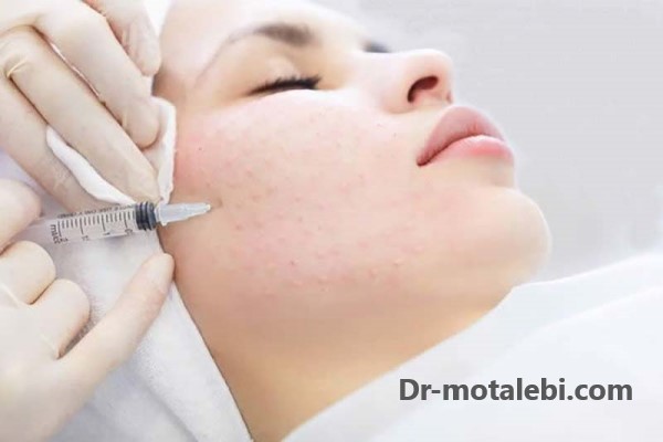 مزوتراپی - کلینیک دکتر فهیمه مطلبی