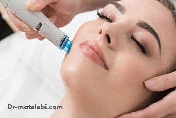 میکرونیدلینگ - کلینیک دکتر فهیمه مطلبی
