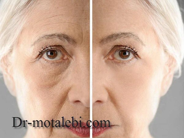 بهترین دستگاه برای لیفت صورت - مطب دکتر فهیمه مطلبی