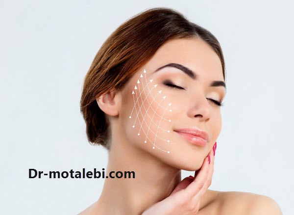 لیفت صورت با نخ برای چه کسی مناسب است؟ - دکتر فهیمه مطلبی