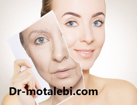 لیفت صورت چیست و چگونه انجام میشود؟ - کلینیک دکتر فهیمه مطلبی