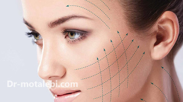 بهترین کلینیک لیفت با نخ در تهران - دکتر فهیمه مطلبی